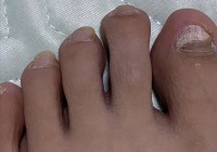 小明术？我们普通人的卦象和卦象，有两类可以提供短生长的方法